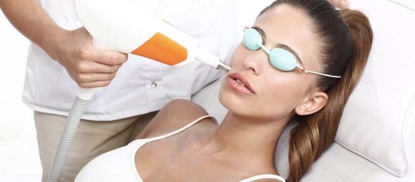 Naha taastamine laseriga